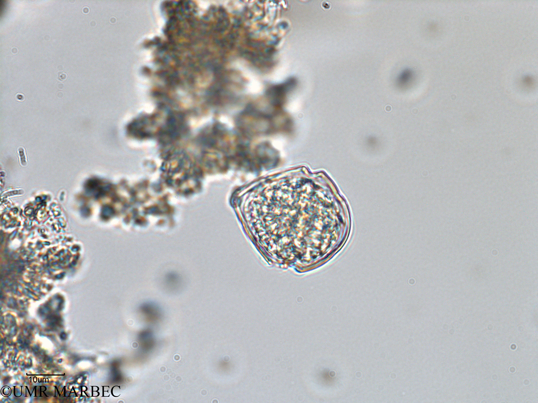 phyto/Bizerte/bizerte_bay/RISCO February 2015/Scrippsiella trochoidea (old Scrippsiella spp -ancien Baie_T5-C2-Scrippsiella spp ou autre-4).tif(copy).jpg